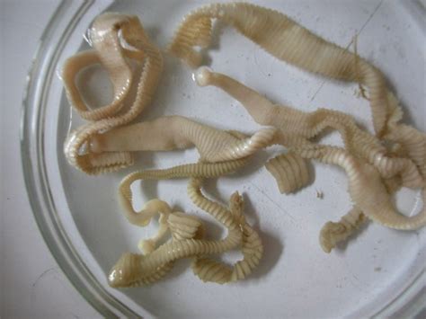 What Is Tapeworm A Tapeworm Is A Parasite That Can Live By Orcasho Medium