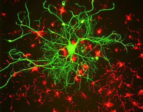 Im Genes De Fluorescencia Datakosine