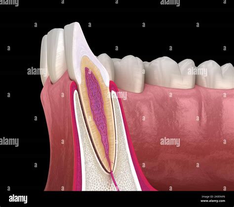 Anatomy Of Maxillary Lateral Incisor Tooth And Gum Cross Section