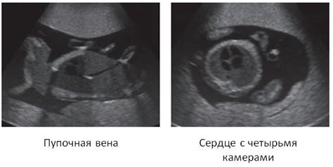 Фетальный фантом для ультразвукового исследования Refus 7a Fetus Ultrasound Examination Phantom