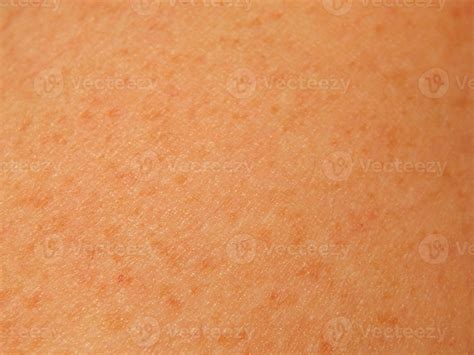 Human Skin Textures