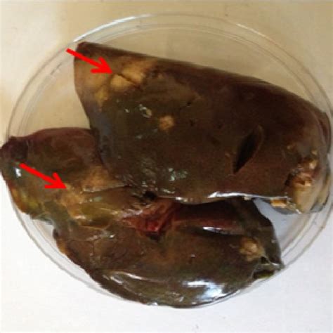 Histopathological examination of liver section showing amoeboid shape ...