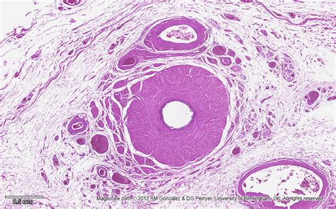 Micrograph Of A Cross Section Of The Human Spermatic Cord