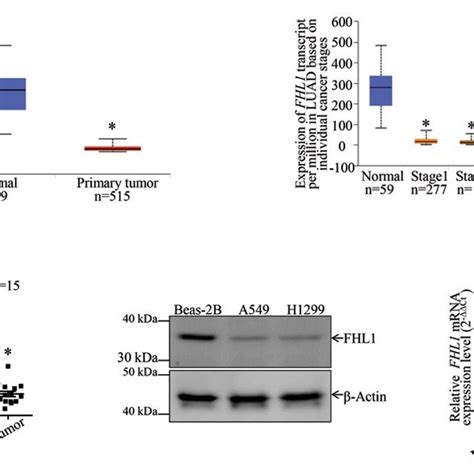 Fhl Was Downregulated In Human Lung Cancer Tissues And Cell Lines A