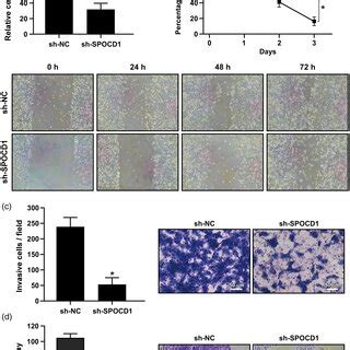 Spocd Down Regulation Inhibited Cell Proliferation Migration