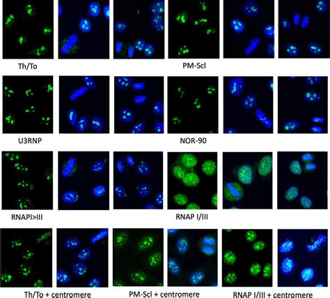 Immunofluorescence Antinuclear Antibodies Hep 2 Ana Slides Mbl Inc