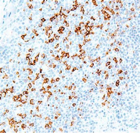 Anti PD 1 Antibody 34067 QED Bioscience Inc