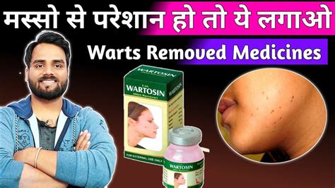 मसस क इलज masse ko kaise hataye wartosin wart remover warts