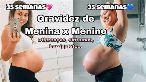 GRAVIDEZ MENINA X GRAVIDEZ DE MENINO Principais Diferenças sintomas