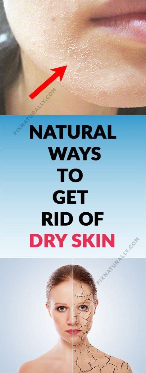 Home Remedies For Dry Skin Natural Ways To Get Rid Of Dry Skin Fix Naturally Dry Skin On