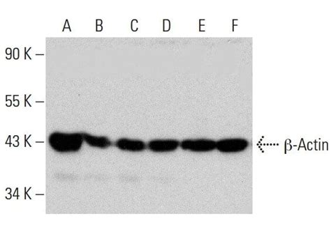 beta Actin Antibody (2A3) | SCBT - Santa Cruz Biotechnology