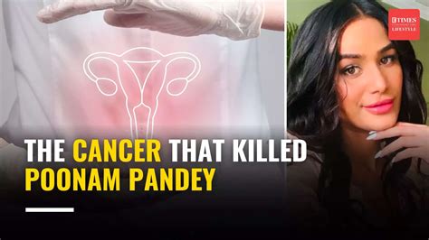 Model Actor Poonam Pandey Dies Of Cervical Cancer All You Need To Know About This Cancer And