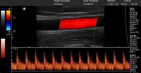 Ecograf A Doppler Venosa Y Arterial Centro De Diagn Stico Por