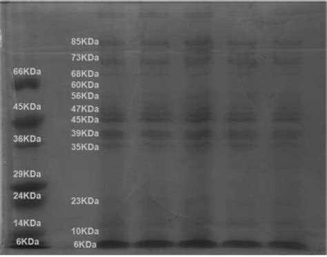 Sds Polyacrylamide Gel Electrophoresis 18 Lane 1 Molecular Weight Download Scientific