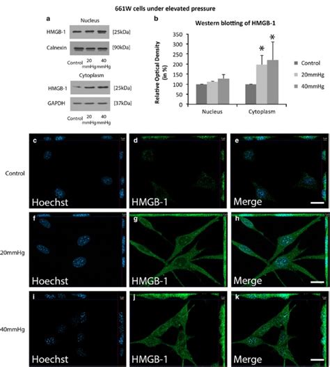 The Pro Inflammatory Role Of High Mobility Group Box 1 Protein HMGB 1