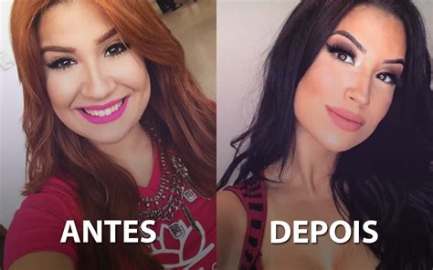 Confira O Antes E Depois De Famosas Que Fizeram Rinoplastia Paipee