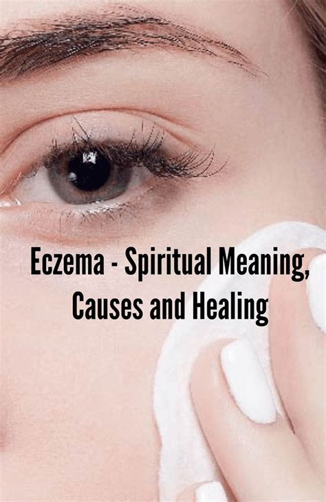 Eczema Spiritual Meaning Causes And Healing Eczema Treatment How