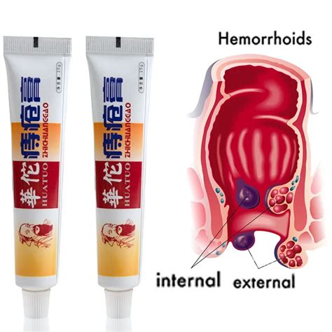 25g Hemorrhoids Ointment Chinese Herbs Crack Internal And External Anal