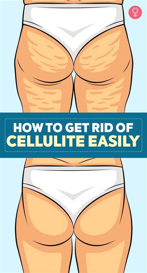 Effective Ways To Get Rid Of Cellulite Naturally Effectively Artofit