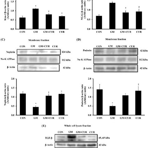 Effect Of Curcumin On Kim Ngal Nephrin Podocin And Tgf B