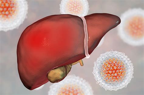 Improved Liver Function Following Eradication Of Hepatitis C Virus