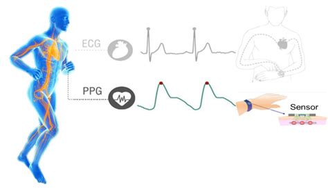 Safety and Functional Test of Wearable Photoplethysmogram (PPG) Smart ...