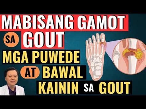 Mabisang Gamot Sa GOUT Mga Bawal At Puwede Kainin Sa Gout By Doc