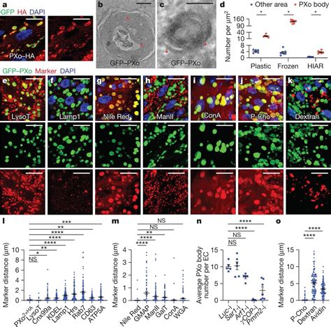 Uri Manor On Twitter Wild A Phosphate Sensing Organelle Regulates