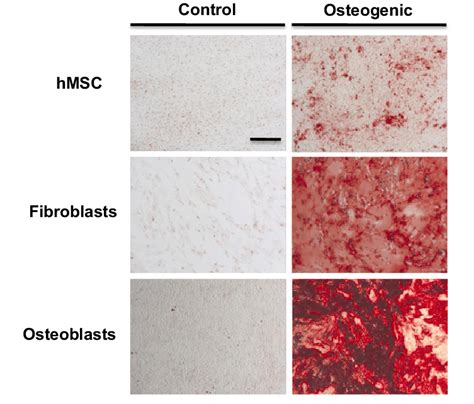 Alizarin Red Staining On Tcps In Control And Osteogenic Media For Human Download Scientific