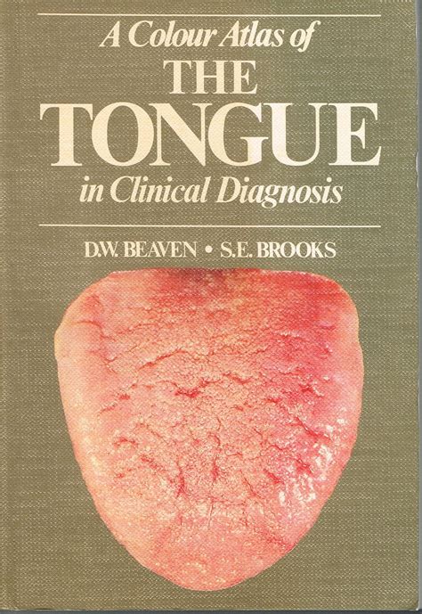 A Colour Atlas Of The Tongue In Clinical Diagnosis Beaven Mb Chb Nz