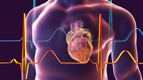 Miocarditis Qué Es Síntomas Y Tratamiento Top Doctors