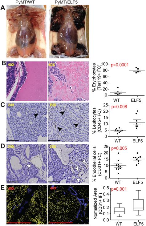 Elf5 Produces Hemorrhagic Mammary Tumors And Increased Tumor Download Scientific Diagram