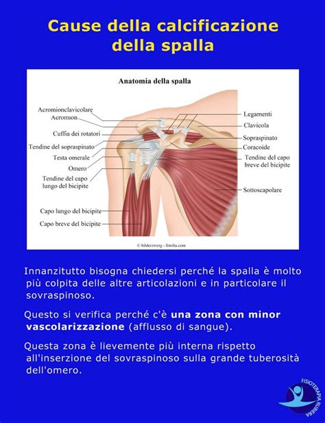 Calcificazione Alla Spalla Le Cause I Sintomi E La Fisioterapia