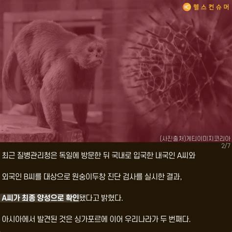 카드뉴스 원숭이두창 국내도 뚫렸다 헬스컨슈머