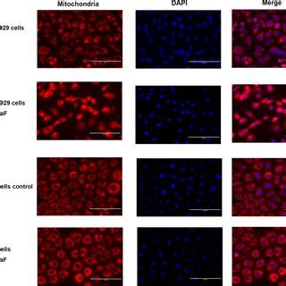 Morphologic Changes In The Mitochondria Of Regular And Fr L Cells