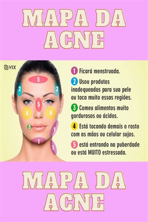 Por Que As Espinhas Aparecem Em Diferentes Locais Do Rosto Body Skin