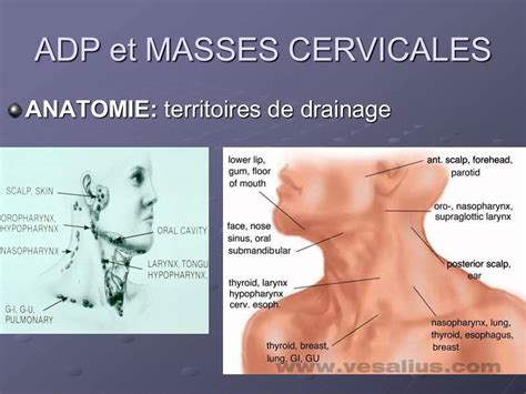 Adenopatia Cervical