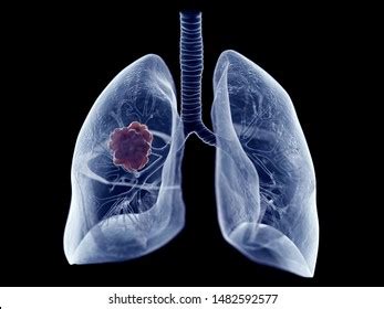 D Rendered Medically Accurate Illustration Lung Stock Illustration