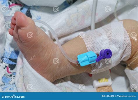 Peripheral Intravenous Catheter in the Vein of Newborn Baby Foot Stock ...