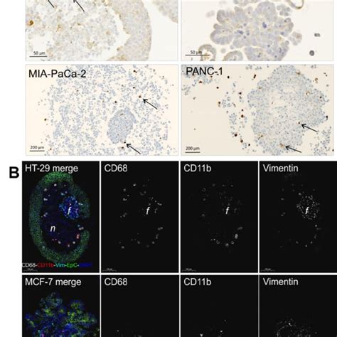 Histological Assessment Of Macrophages In Spheroids Spheroids Were