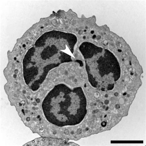 Fig Neutrophil Extracellular Traps Is Immunity The Second Function Of