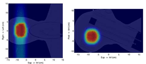 Figure From Monte Carlo Validation Of Proton Treatment Plans Using