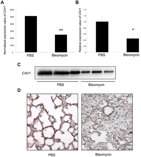 Altered Cav Expression In Bleomycin Induced Lung Fibrosis Mouse Model