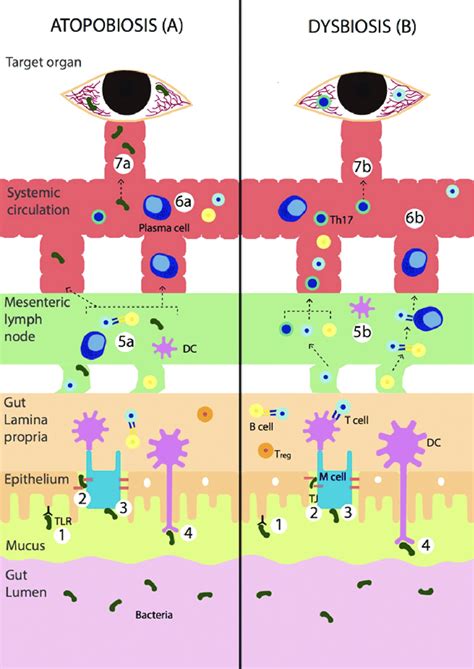 Illustrated Pathogenesis Of Atopobiosis And Dysbiosis In Relation To Download Scientific