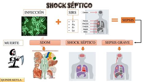 Shock S Ptico Salud Apuntes De Medicina Udocz