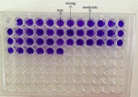 Microtitre Platting Technique [11] Download Scientific Diagram