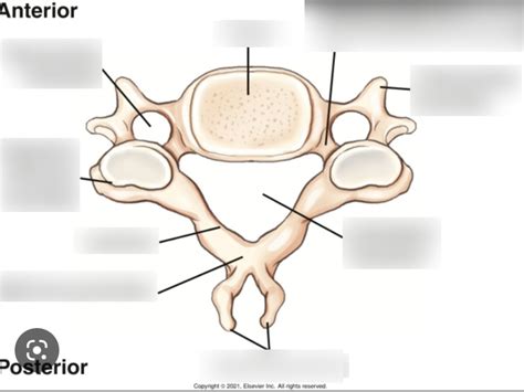 typical c3-c6 vertebrae Diagram | Quizlet