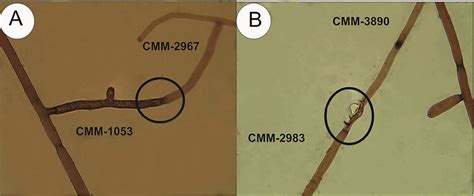 Hyphal Anastomosis Between Rhizoctonia Solani Isolates Images At 400x