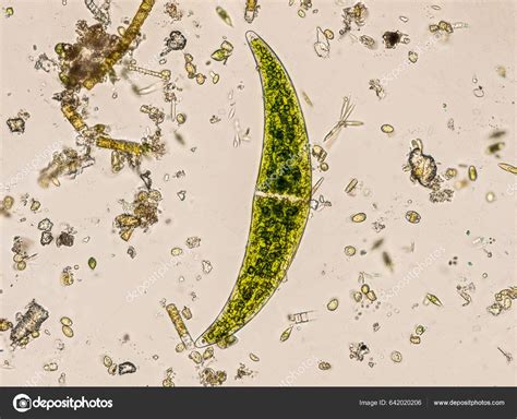 Freshwater Closterium Algae Unicellular Charophyte Green Algae Optical ...