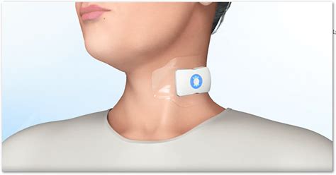 Flopatch Worlds First Wearable Ultrasound Device Deployed In Hospital